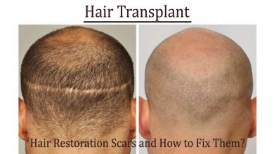 hair transplant- Hair Restoration Scars and How to Fix Them?