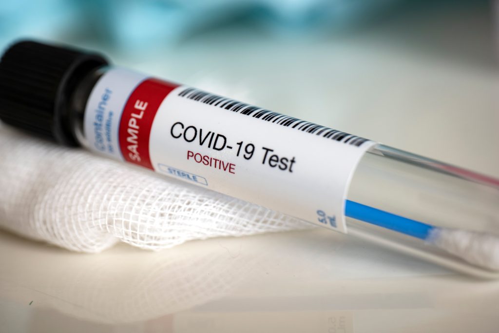 PCR Test Locations