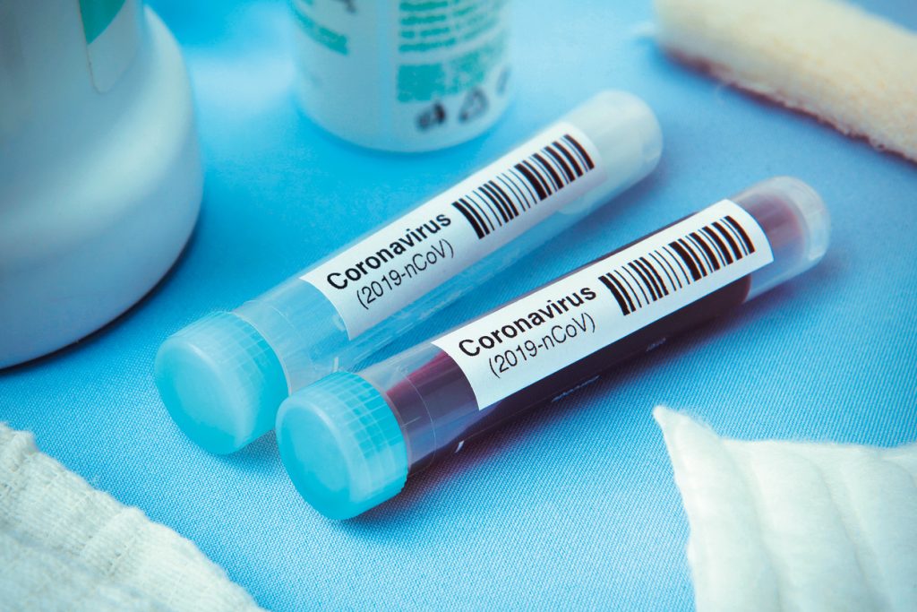 PCR Test Locations