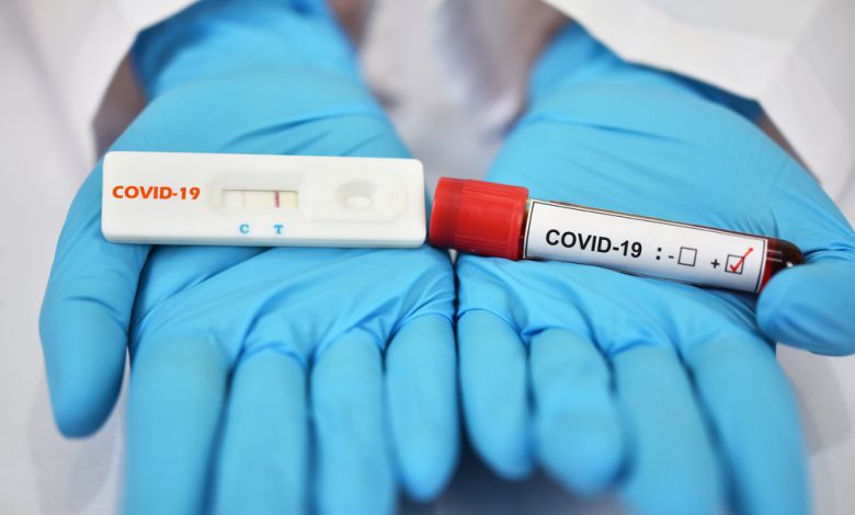 PCR Test Locations