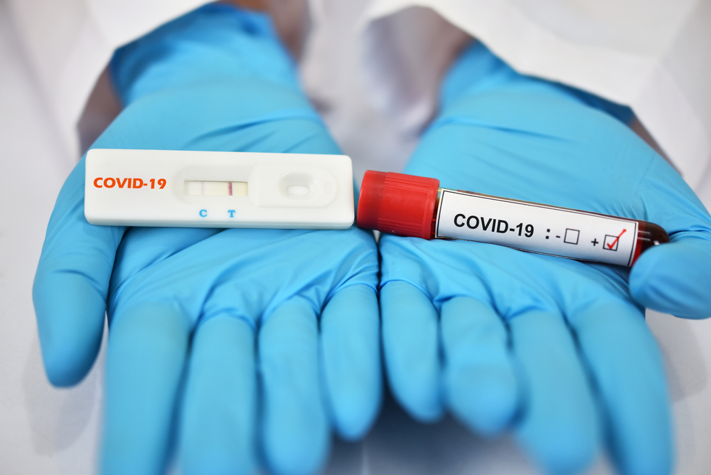 PCR Test Locations